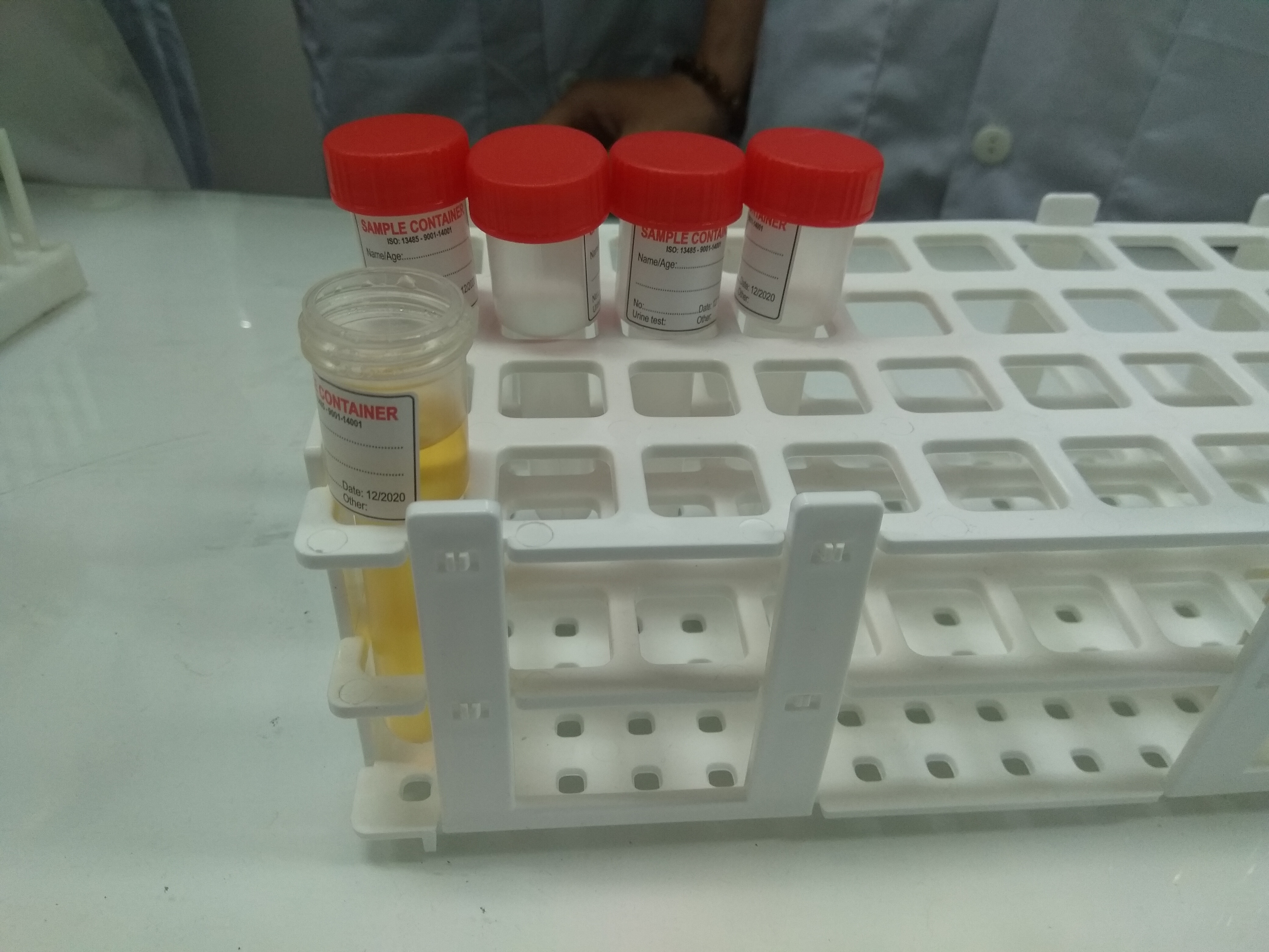 Giá ống nghiệm đựng nước tiểu