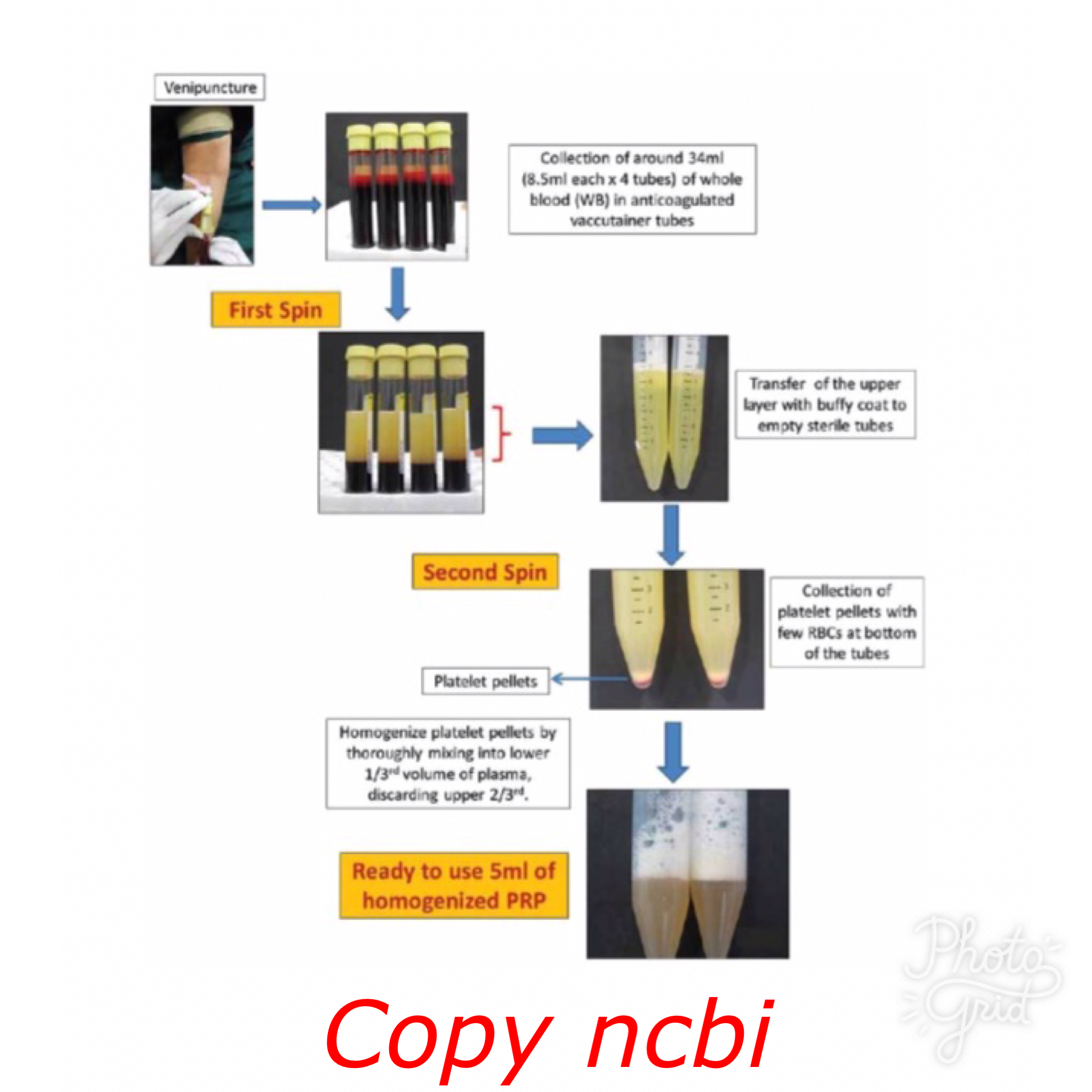 PRP PLATELET RICH PLASMA