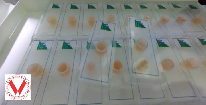 CLOTEST