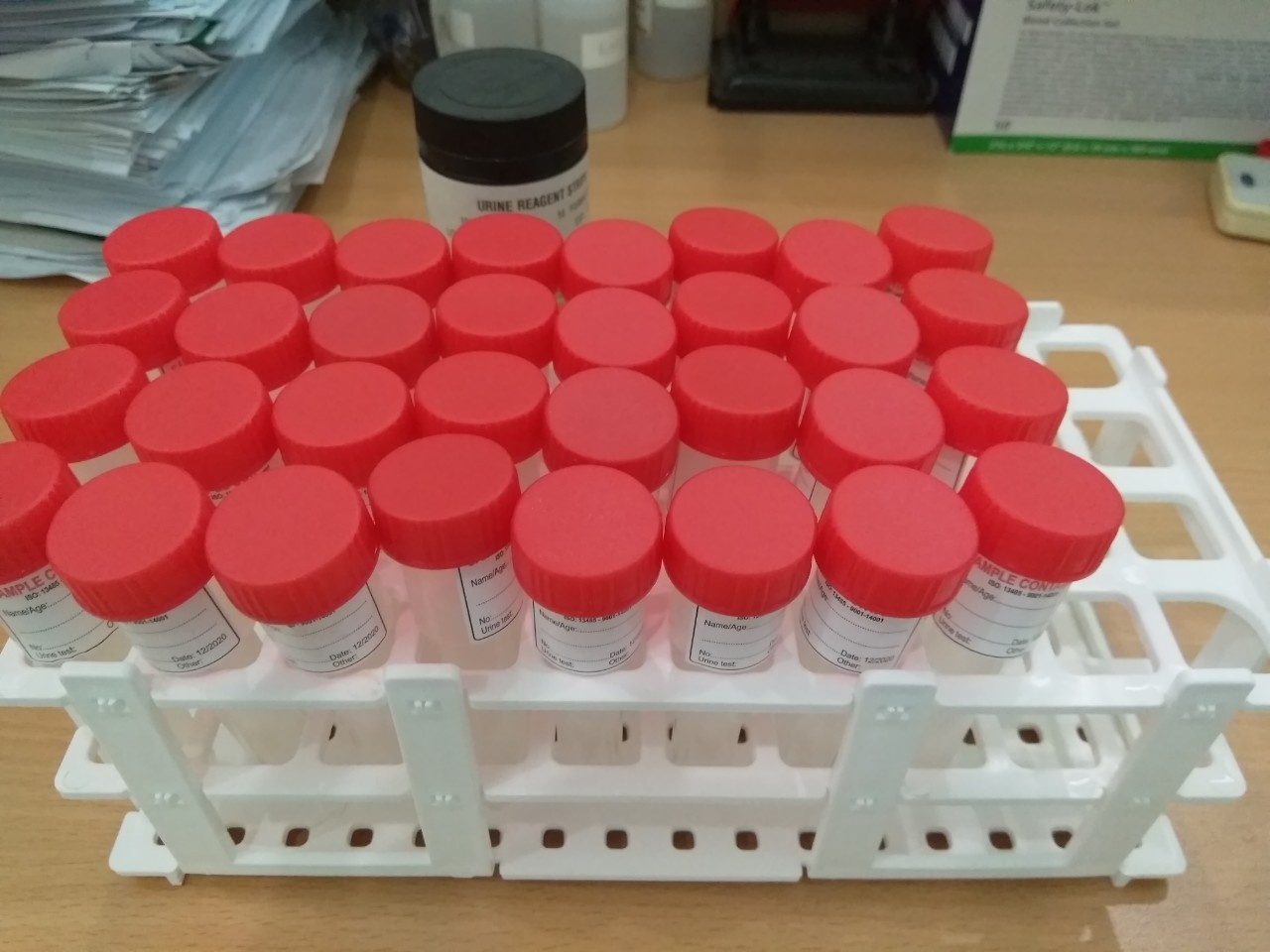 lọ nhựa 20 ml nắp đỏ lọ nhựa 20 ml)